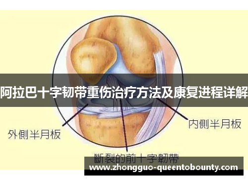 阿拉巴十字韧带重伤治疗方法及康复进程详解